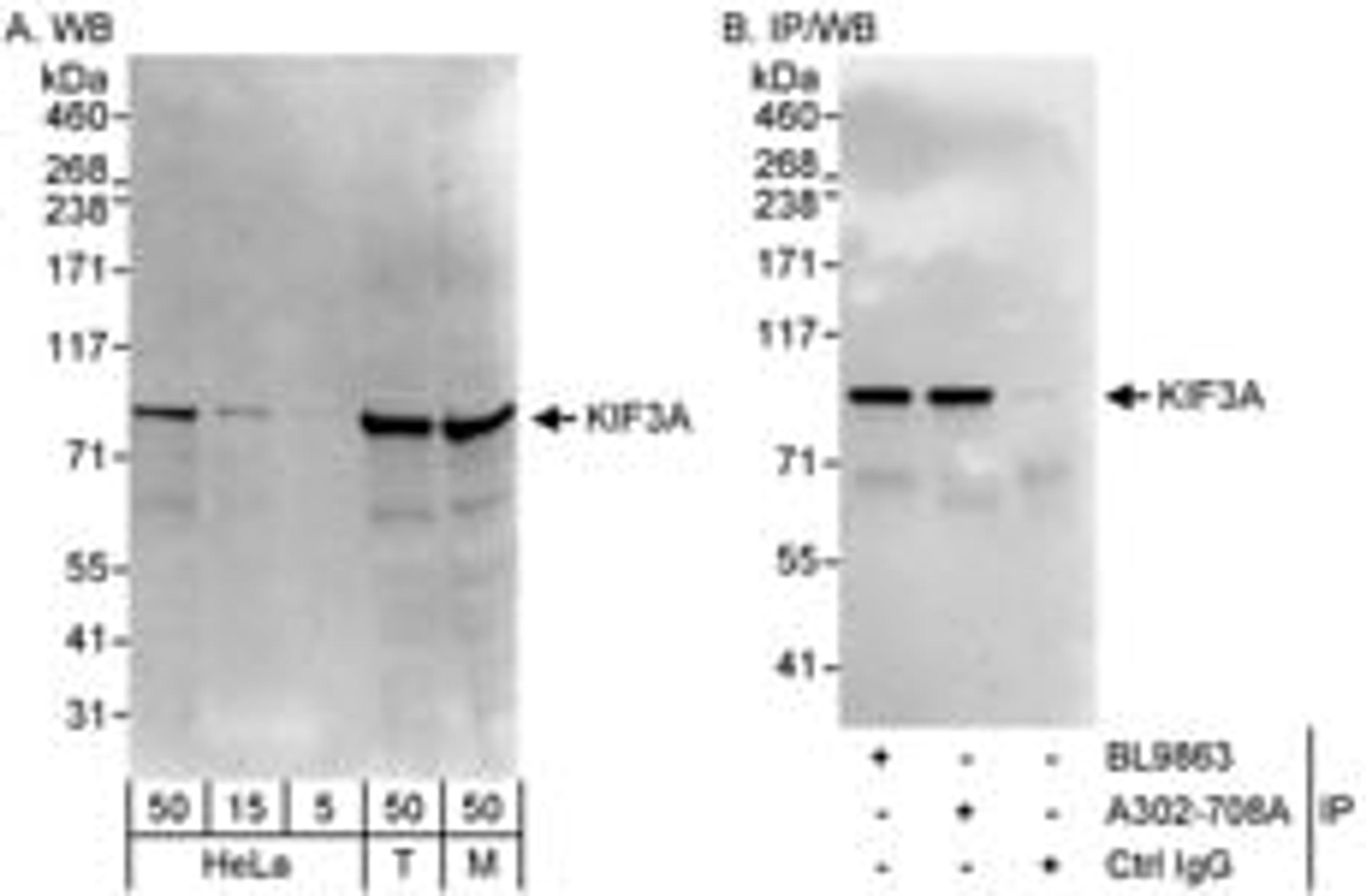 Detection of human and mouse KIF3A by western blot (h&m) and immunoprecipitation (h).