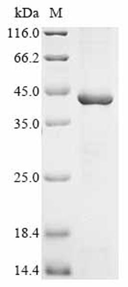 (Tris-Glycine gel) Discontinuous SDS-PAGE (reduced) with 5% enrichment gel and 15% separation gel.
