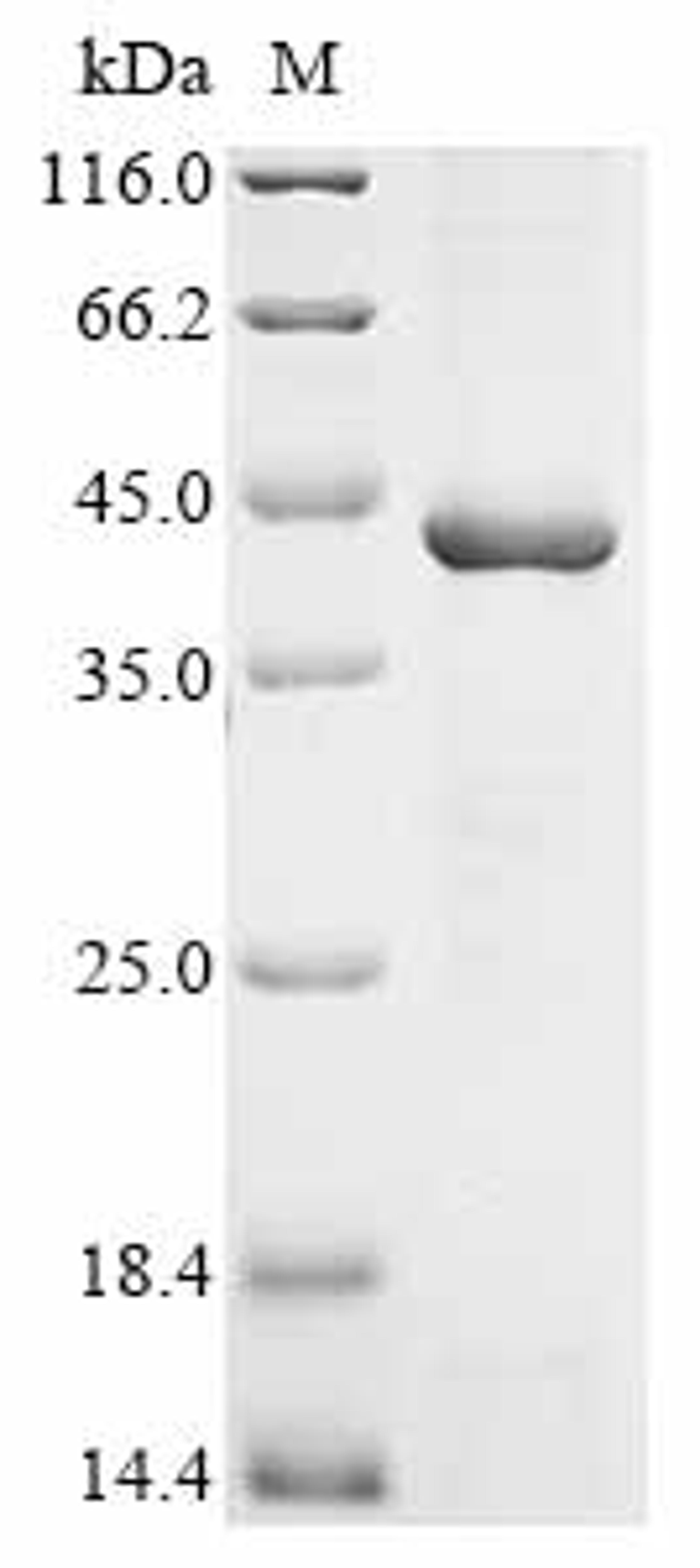 (Tris-Glycine gel) Discontinuous SDS-PAGE (reduced) with 5% enrichment gel and 15% separation gel.