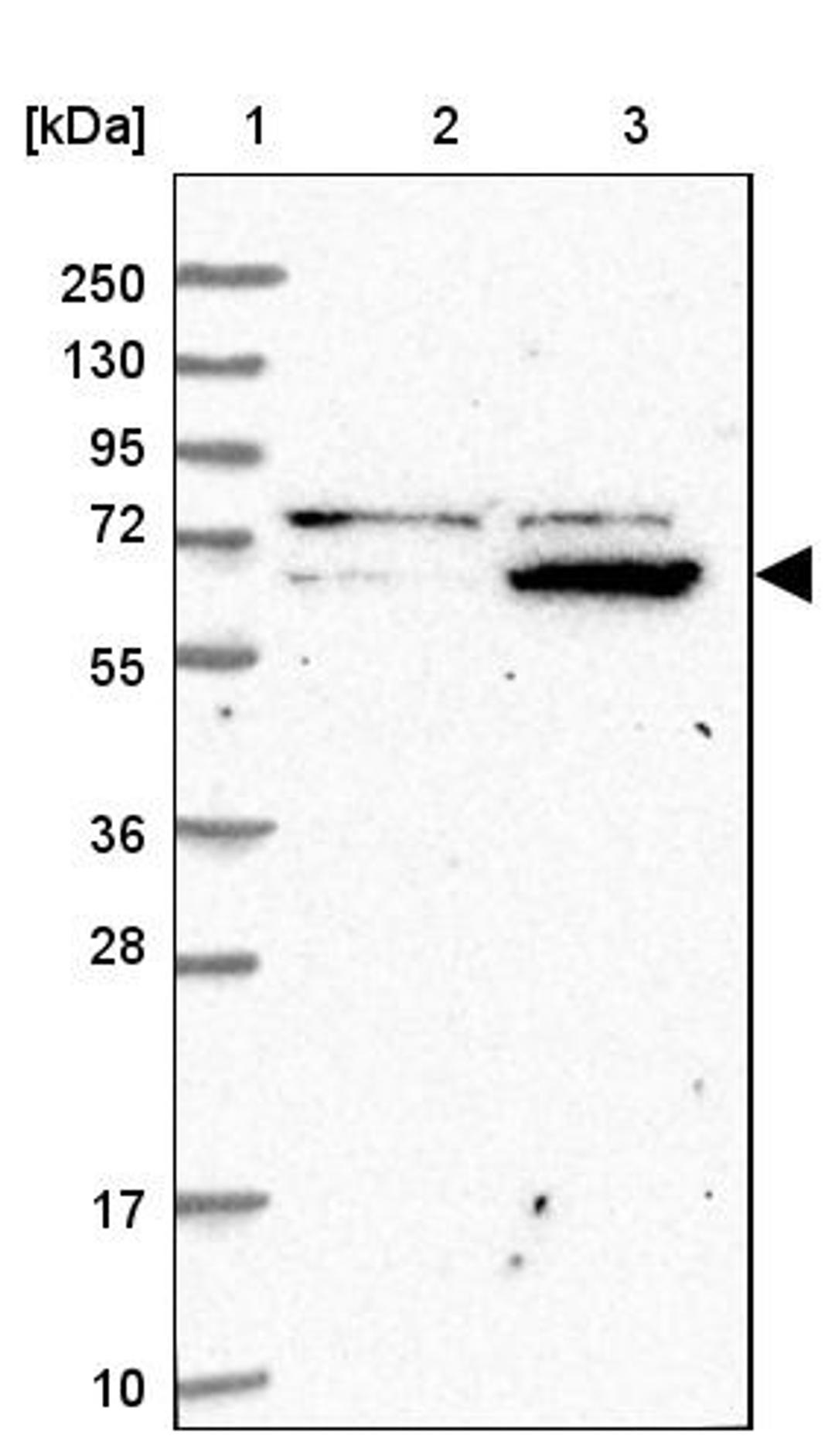 Western Blot: ZNF324 Antibody [NBP1-86836] - Lane 1: Marker [kDa] 250, 130, 95, 72, 55, 36, 28, 17, 10<br/>Lane 2: Human cell line RT-4<br/>Lane 3: Human cell line U-251MG sp