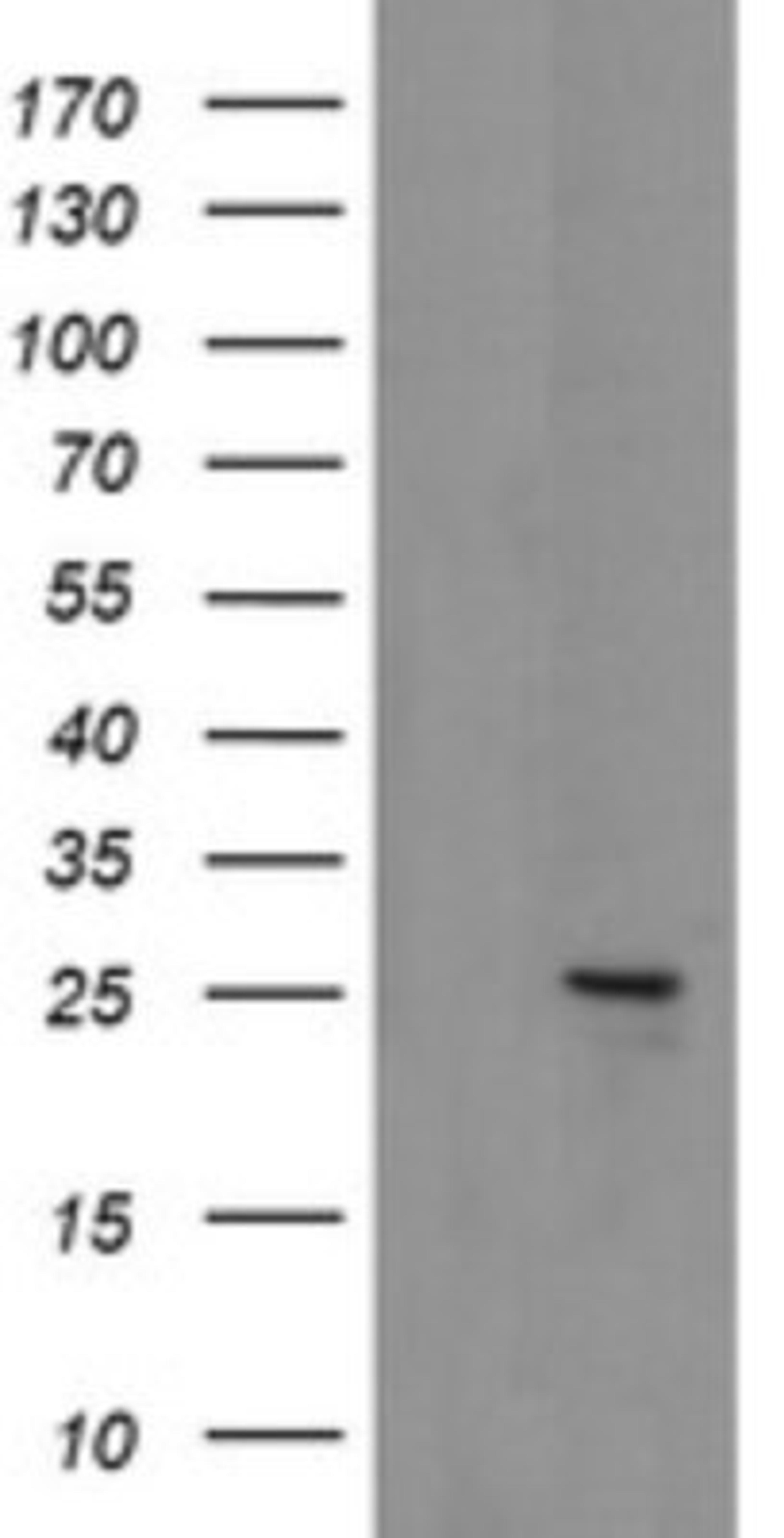 Western Blot: MRPS34 Antibody (4H2) [NBP2-45432] - Analysis of HEK293T cells were transfected with the pCMV6-ENTRY control (Left lane) or pCMV6-ENTRY MRPS34.