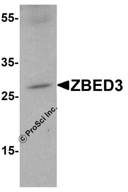 Western blot analysis of ZBED3 in A-20 cell lysate with ZBED3 antibody at 1 μg/ml.