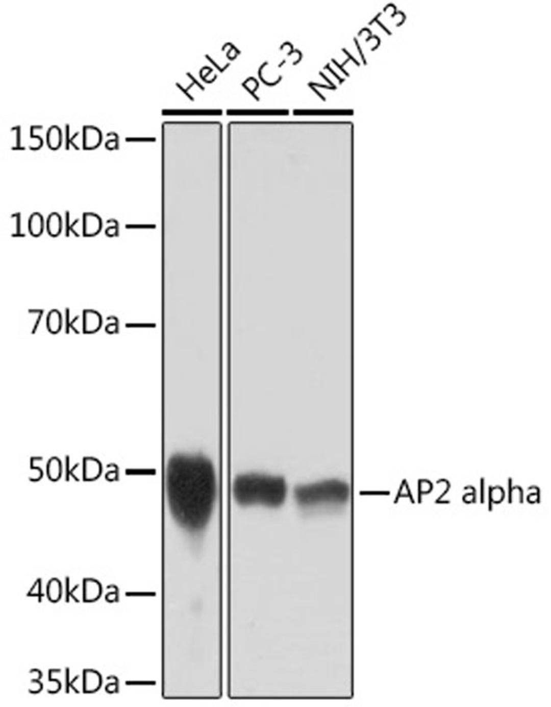 Western blot - AP2 alpha Rabbit mAb (A2294)