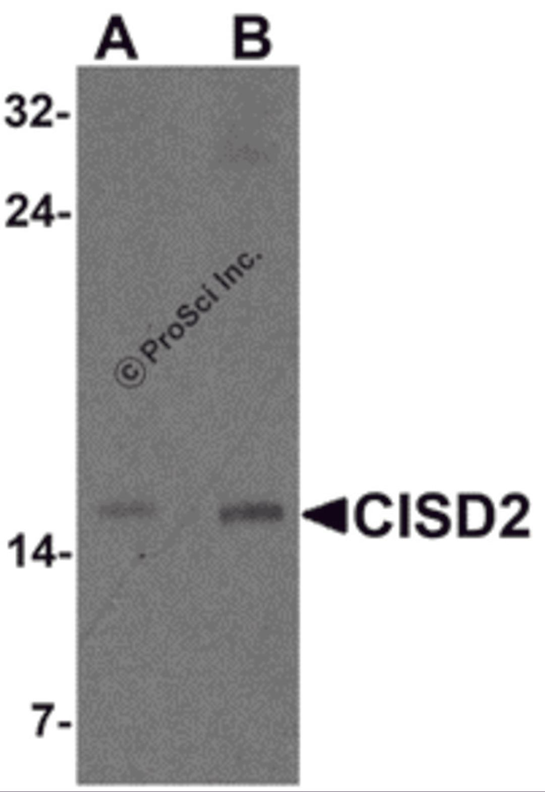 Western blot analysis of CISD2 in rat brain tissue lysate with CISD2 antibody at (A) 1 and (B) 2 &#956;g/m