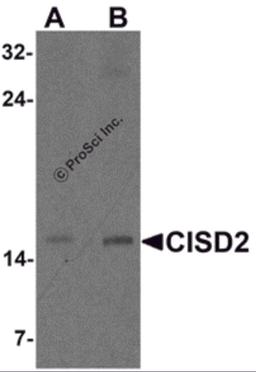 Western blot analysis of CISD2 in rat brain tissue lysate with CISD2 antibody at (A) 1 and (B) 2 μg/m