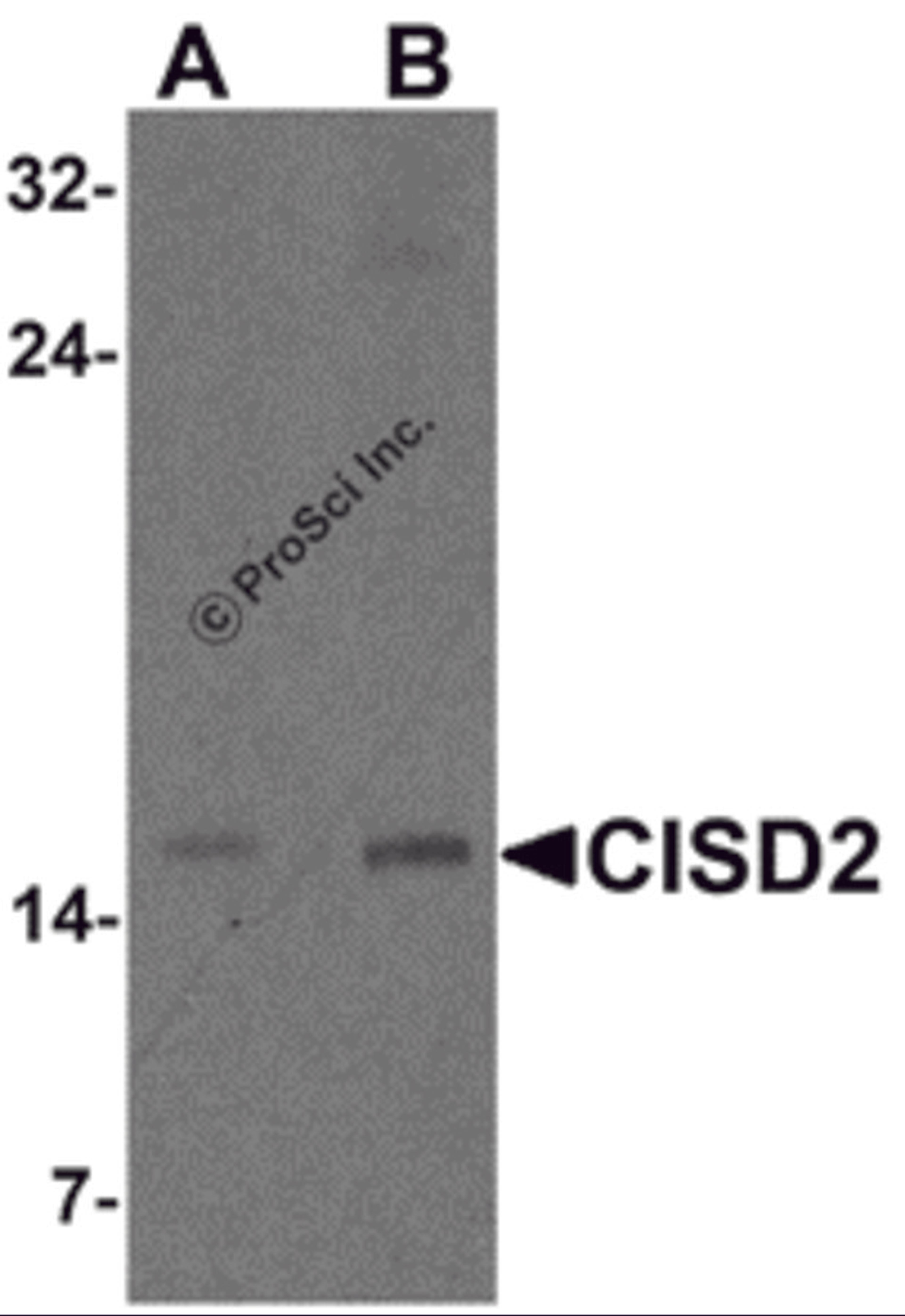 Western blot analysis of CISD2 in rat brain tissue lysate with CISD2 antibody at (A) 1 and (B) 2 μg/m