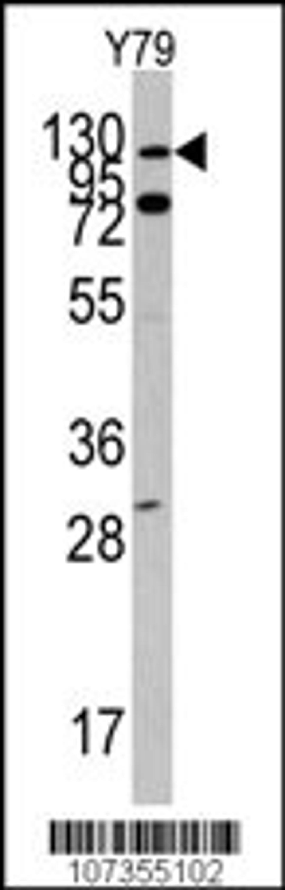 Western blot analysis of in Y79 cell line lysates (35ug/lane)