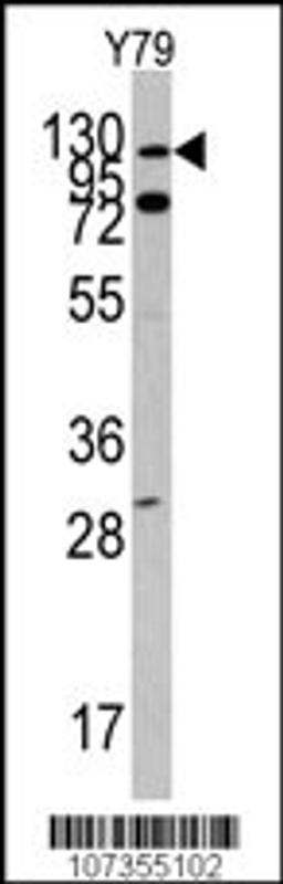 Western blot analysis of in Y79 cell line lysates (35ug/lane)