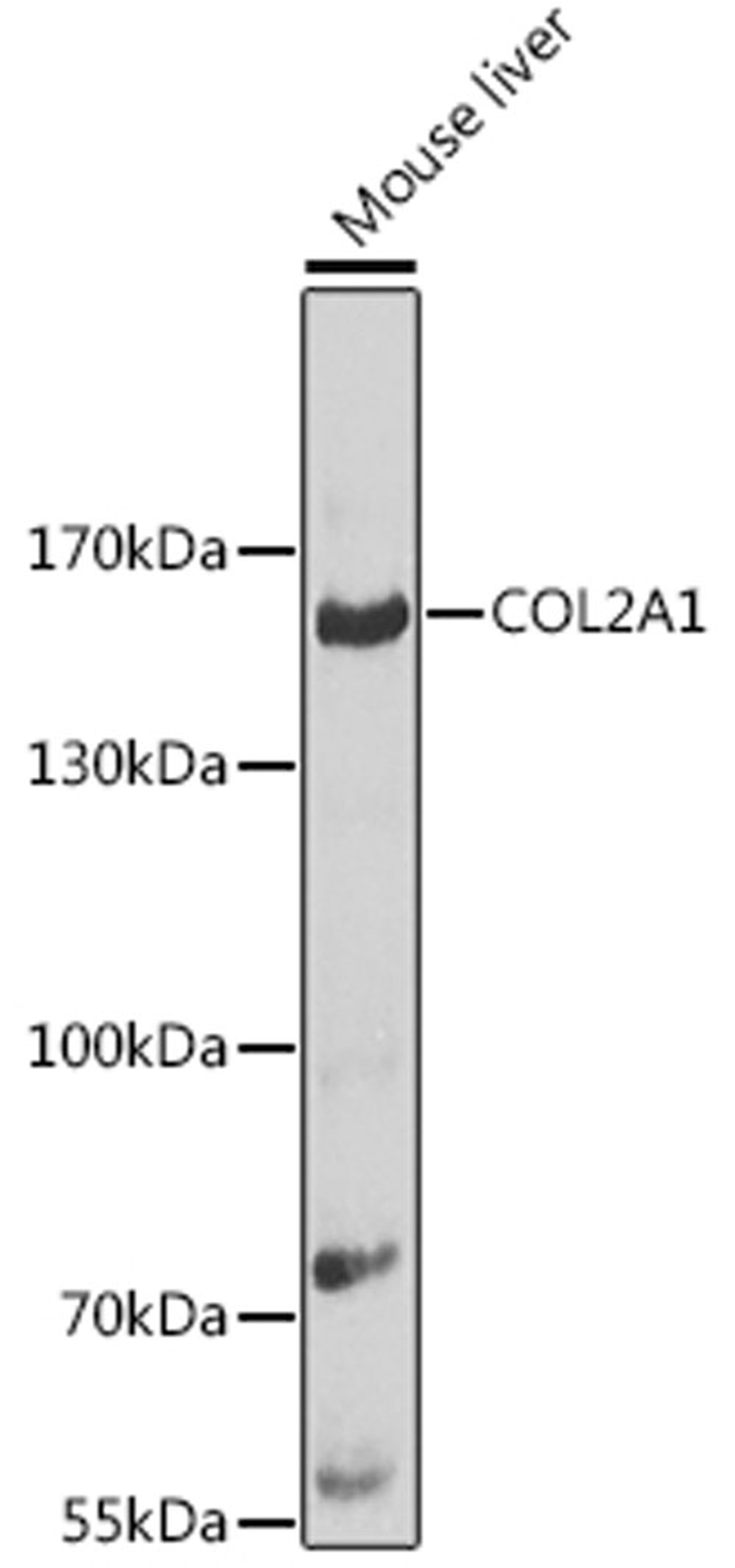 Western blot - COL2A1 antibody (A1560)