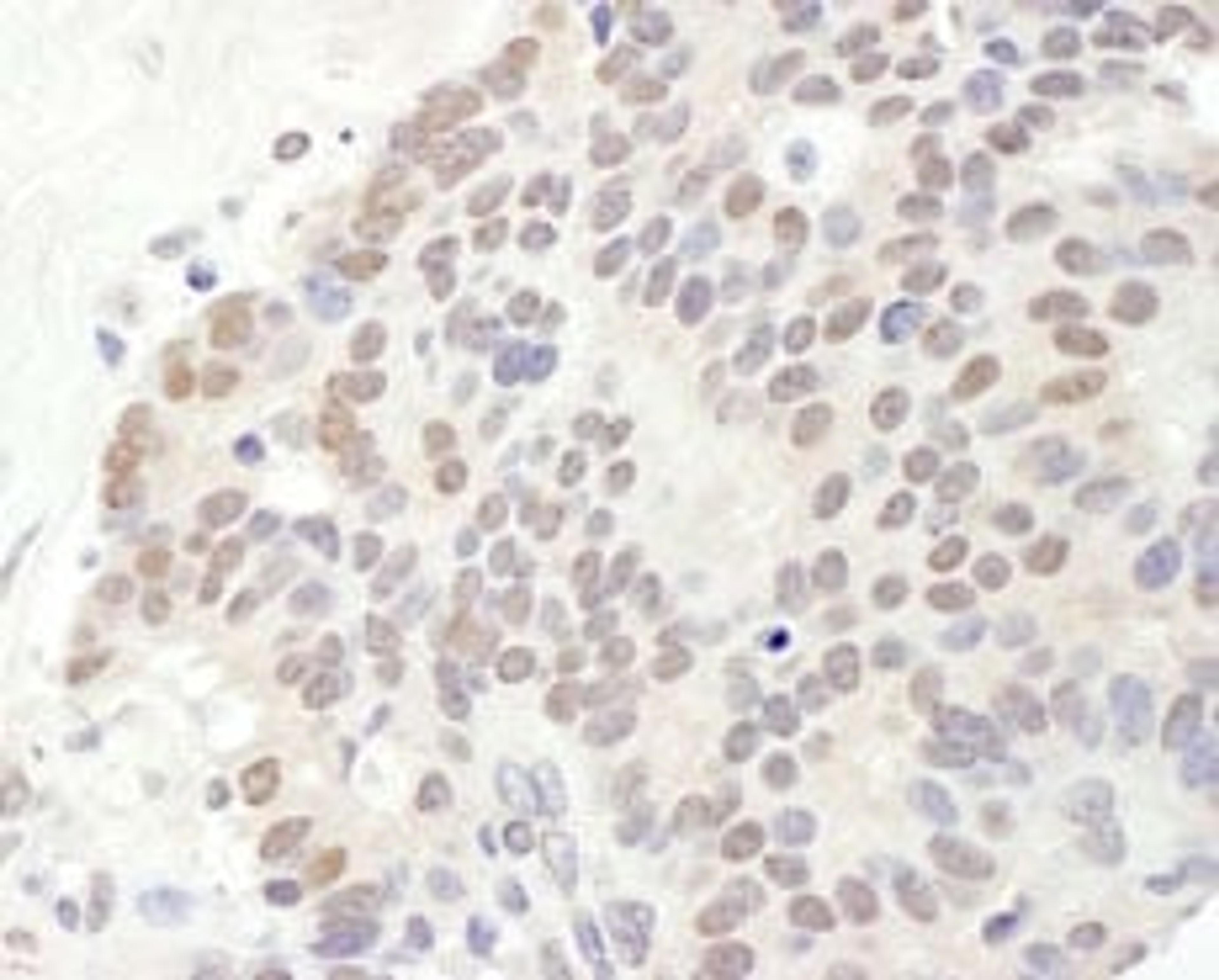 Detection of human TRPS1 by immunohistochemistry.