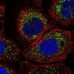 Immunocytochemistry/Immunofluorescence: C9orf173 Antibody [NBP1-93783] - Staining of human cell line A-431 shows positivity in vesicles.