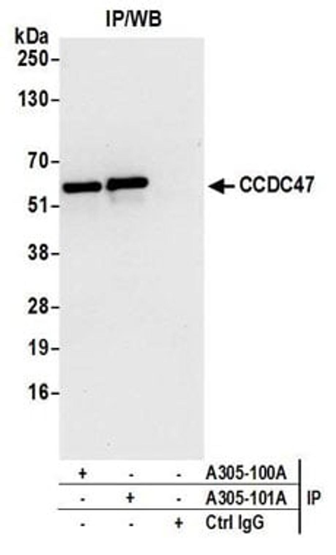 Detection of human CCDC47 by western blot of immunoprecipitates.