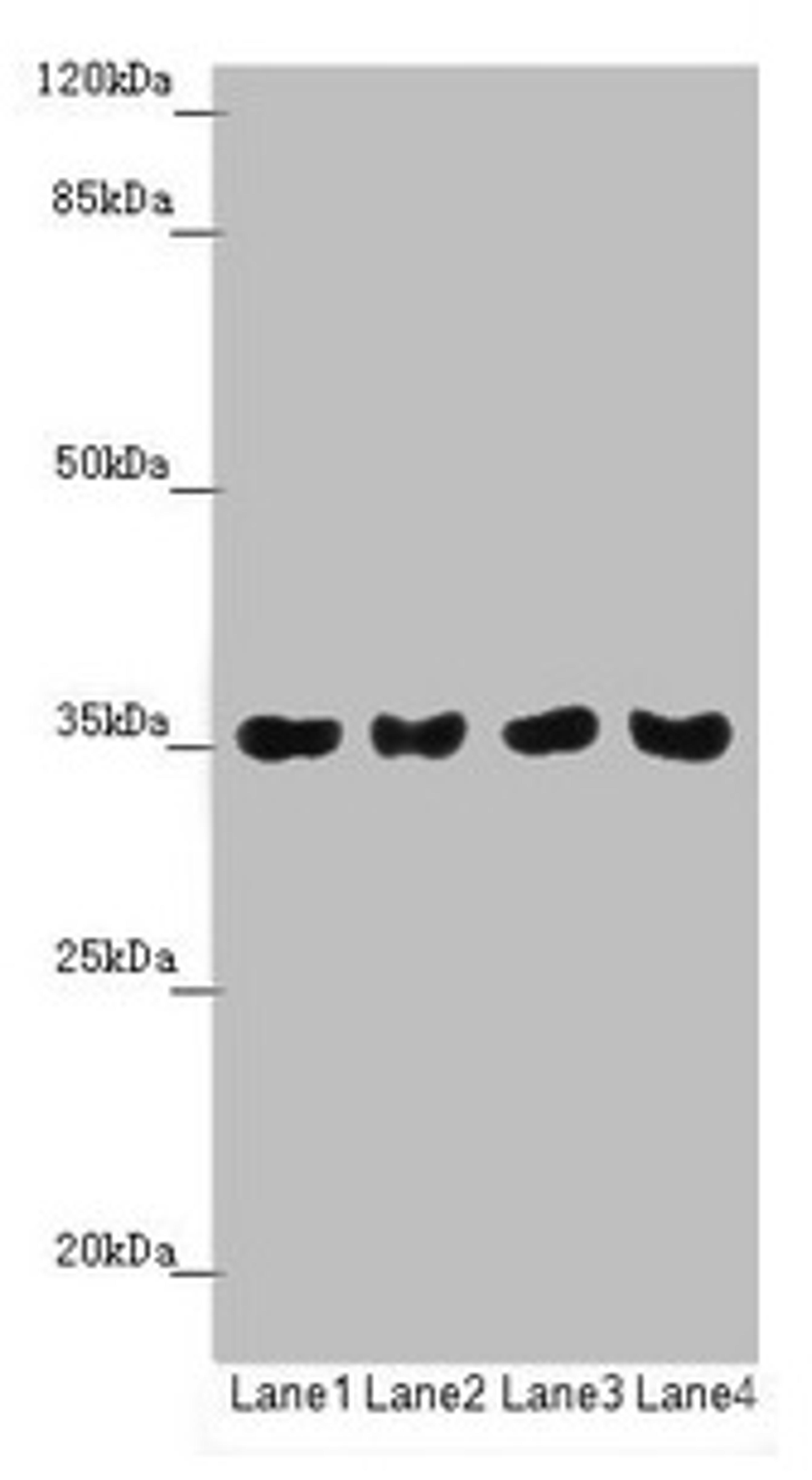 Western blot. All lanes: TOMM34 antibody at 1.42µg/ml. Lane 1: Mouse gonadal tissue. Lane 2: A549 whole cell lysate. Lane 3: PC-3 whole cell lysate. Lane 4: A375 whole cell lysate. Secondary. Goat polyclonal to rabbit IgG at 1/10000 dilution. Predicted band size: 35 kDa. Observed band size: 35 kDa