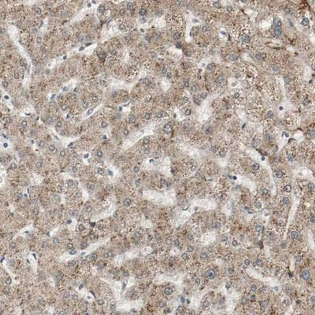 Immunohistochemistry-Paraffin: Melanotransferrin/CD228/MFI2 Antibody [NBP1-85777] - Staining of human liver shows moderate cytoplasmic positivity in hepatocytes.