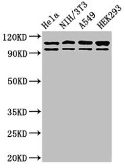 Western Blot. Positive WB detected in: Hela whole cell lysate, NIH/3T3 whole cell lysate, A549 whole cell lysate, HEK293 whole cell lysate. All lanes: MSH2 antibody at 2ug/ml. Secondary. Goat polyclonal to rabbit IgG at 1/50000 dilution. Predicted band size: 105, 98 kDa. Observed band size: 105, 98 kDa. 