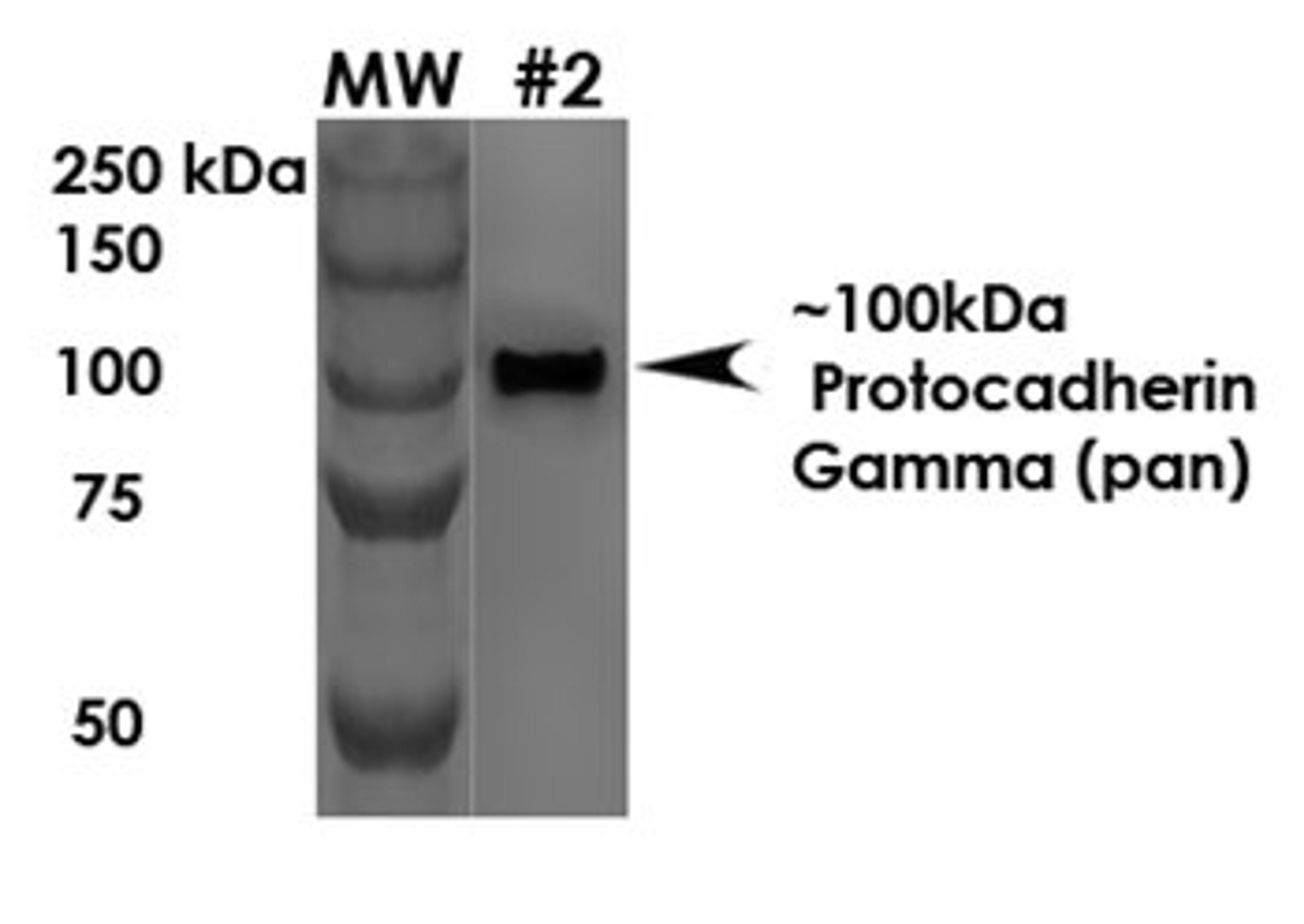 Western Blot analysis of rat brain membrane using Protocadherin Gamma antibody