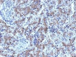 IHC testing of FFPE human fetal liver tissue with recombinant Glypican-3 antibody (clone GPC3/1534R). Required HIER: steam sections in 10mM Tris with 1mM EDTA, pH 9.0, for 10-20 min.