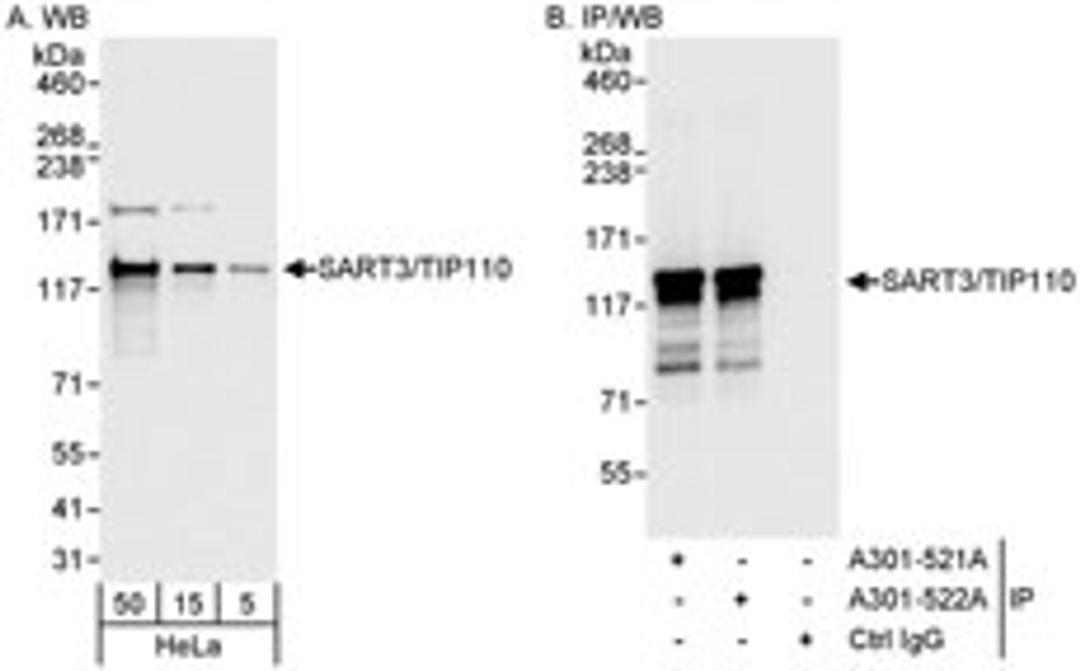 Detection of human SART3/TIP110 by western blot and immunoprecipitation.