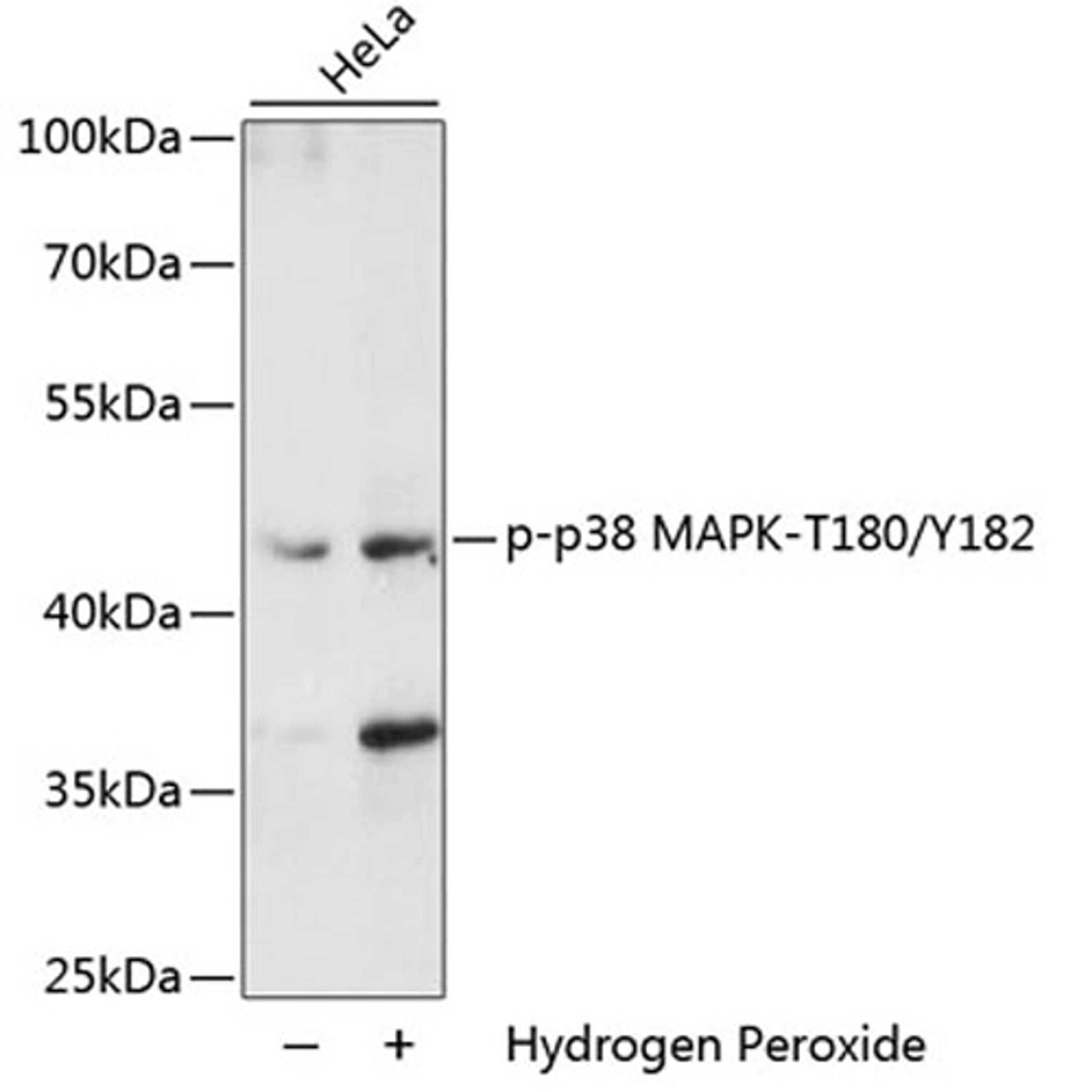 Western blot - Phospho-p38 MAPK-T180/Y182 antibody (AP0526)