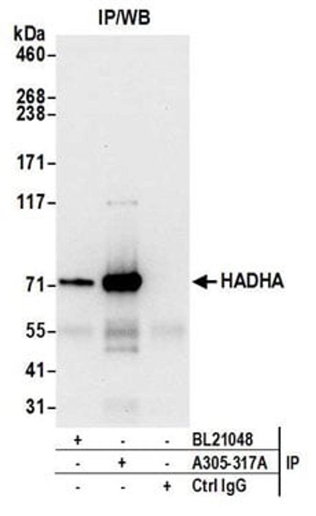 Detection of human HADHA by western blot of immunoprecipitates.