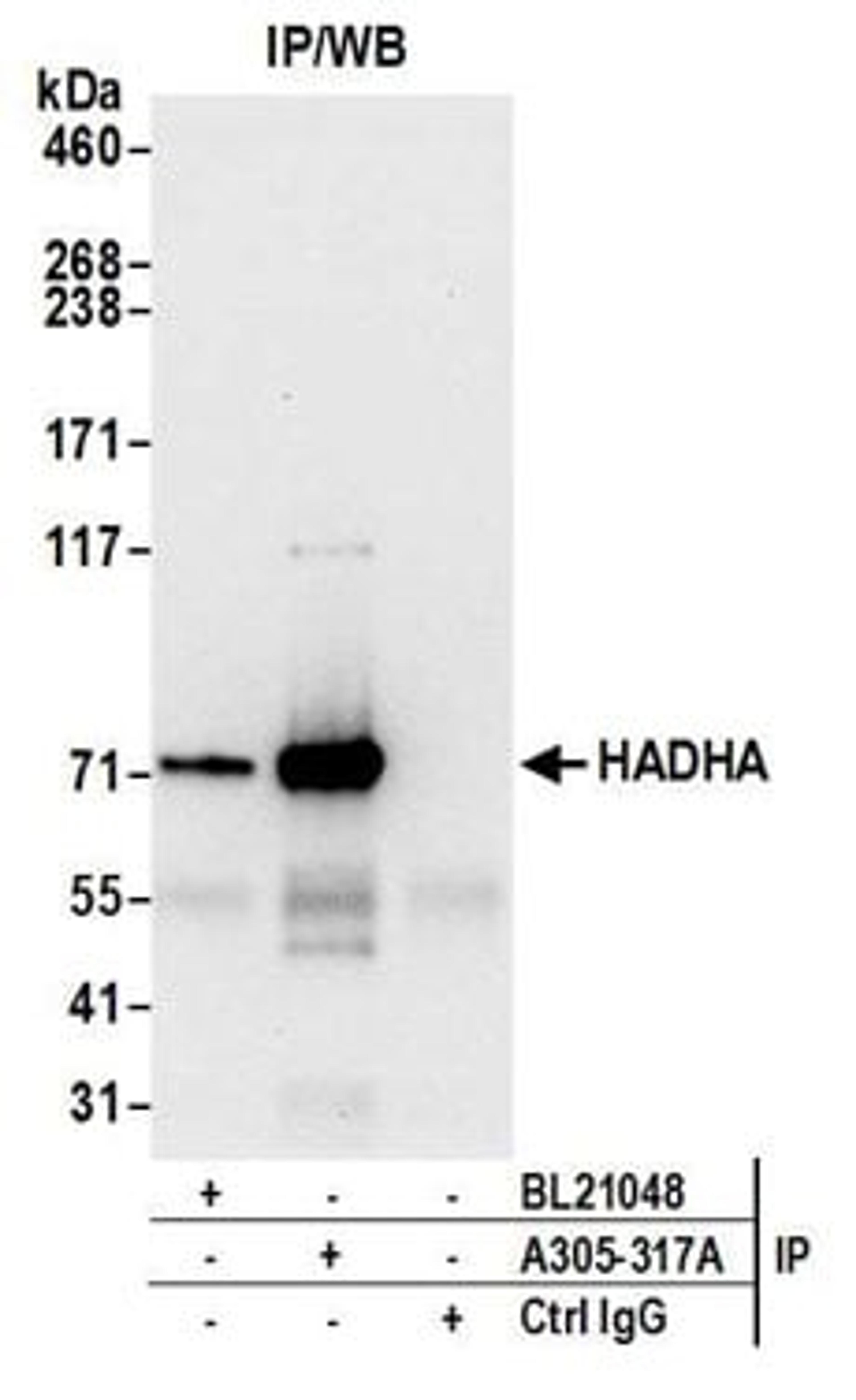 Detection of human HADHA by western blot of immunoprecipitates.