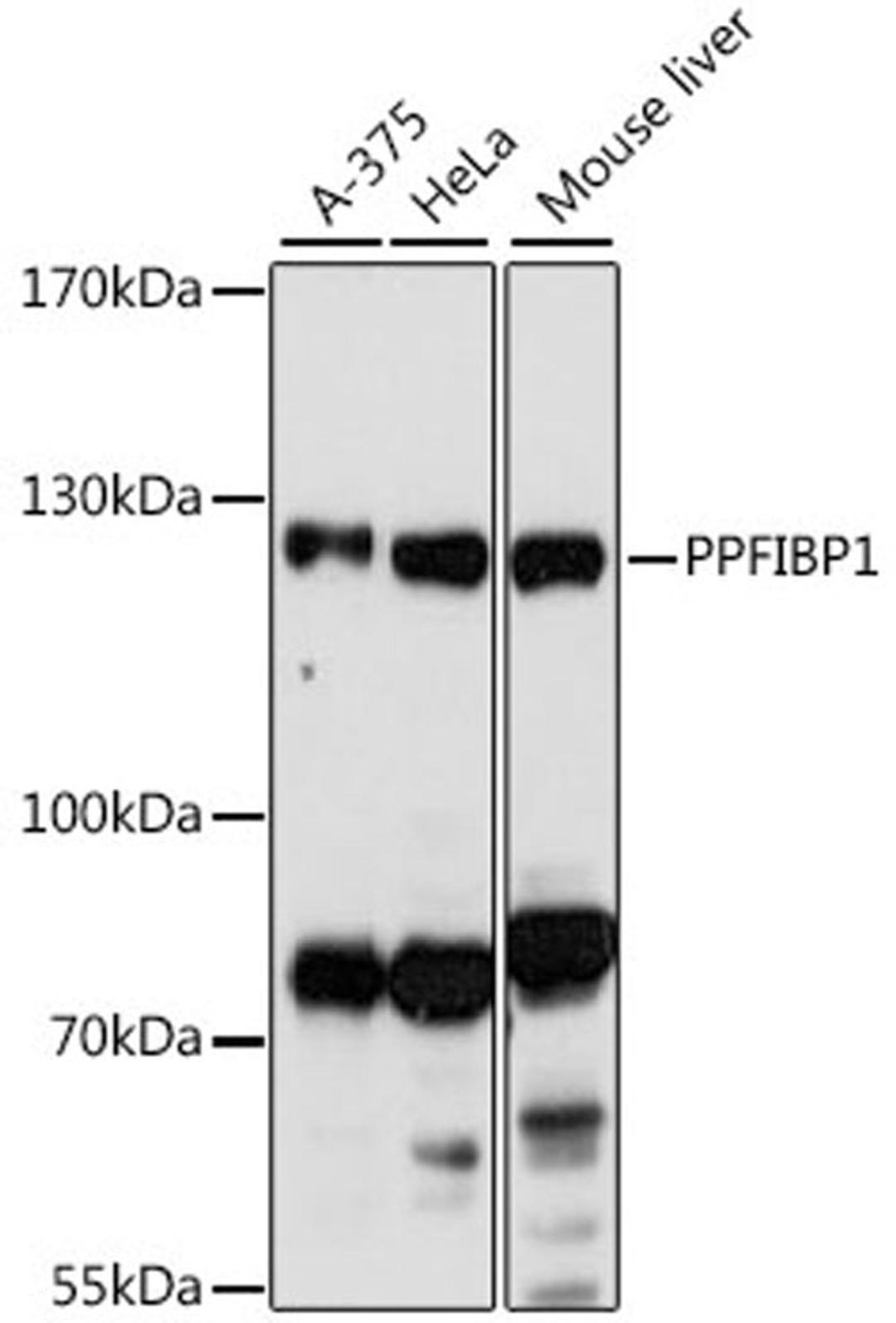 Western blot - PPFIBP1 antibody (A16456)