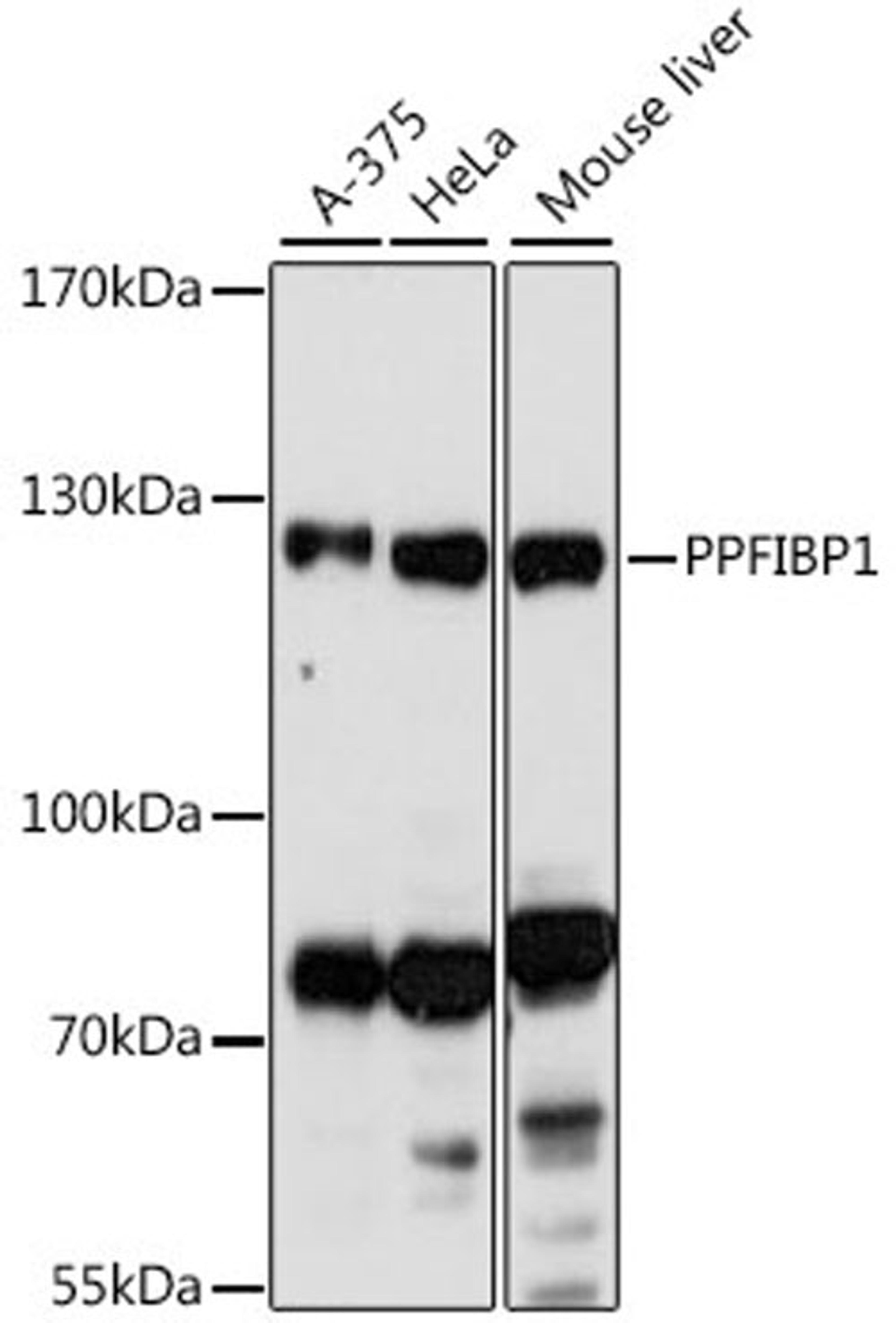 Western blot - PPFIBP1 antibody (A16456)