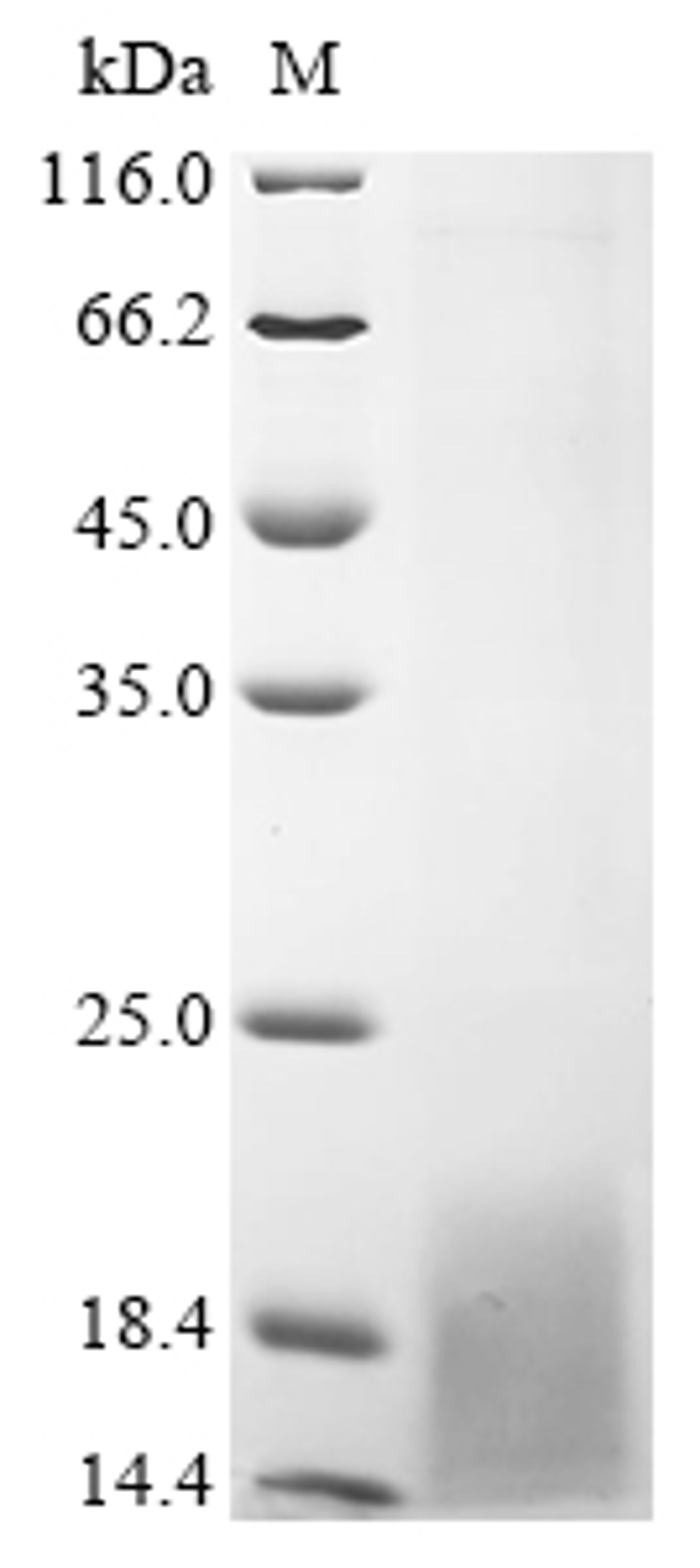 (Tris-Glycine gel) Discontinuous SDS-PAGE (reduced) with 5% enrichment gel and 15% separation gel.