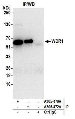 Detection of human WDR1 by western blot of immunoprecipitates.