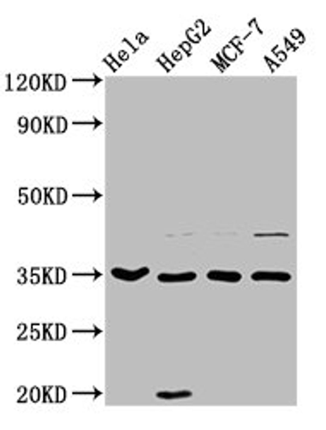 Western Blot. Positive WB detected in: Hela whole cell lysate, HepG2 whole cell lysate, MCF-7 whole cell lysate, A549 whole cell lysate. All lanes: AIMP1 antibody at 3.7µg/ml. Secondary. Goat polyclonal to rabbit IgG at 1/50000 dilution. Predicted band size: 35, 38 kDa. Observed band size: 35 kDa