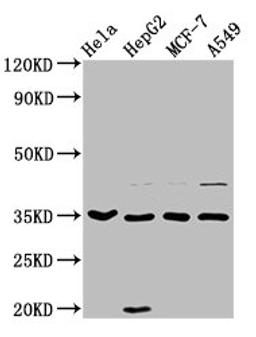 Western Blot. Positive WB detected in: Hela whole cell lysate, HepG2 whole cell lysate, MCF-7 whole cell lysate, A549 whole cell lysate. All lanes: AIMP1 antibody at 3.7µg/ml. Secondary. Goat polyclonal to rabbit IgG at 1/50000 dilution. Predicted band size: 35, 38 kDa. Observed band size: 35 kDa