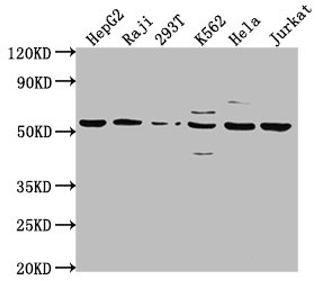 Western Blot. Positive WB detected in: HepG2 whole cell lysate, Raji whole cell lysate, 293T whole cell lysate, K562 whole cell lysate, Hela whole cell lysate, Jurkat whole cell lysate. All lanes: CAP1 antibody at 1:2000. Secondary. Goat polyclonal to rabbit IgG at 1/50000 dilution. Predicted band size: 52 kDa. Observed band size: 52 kDa.