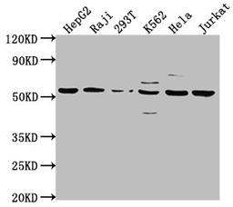 Western Blot. Positive WB detected in: HepG2 whole cell lysate, Raji whole cell lysate, 293T whole cell lysate, K562 whole cell lysate, Hela whole cell lysate, Jurkat whole cell lysate. All lanes: CAP1 antibody at 1:2000. Secondary. Goat polyclonal to rabbit IgG at 1/50000 dilution. Predicted band size: 52 kDa. Observed band size: 52 kDa.