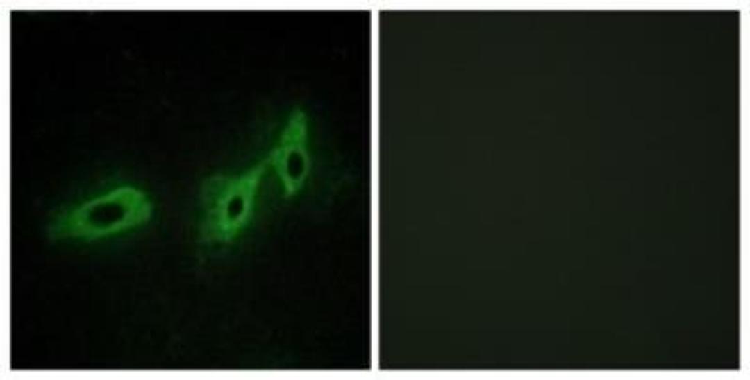 Immunocytochemistry/Immunofluorescence: MID1 Antibody [NBP1-67769] - Analysis of HeLa cells, using . The picture on the right is treated with the synthesized peptide.