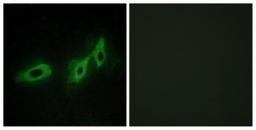 Immunocytochemistry/Immunofluorescence: MID1 Antibody [NBP1-67769] - Analysis of HeLa cells, using . The picture on the right is treated with the synthesized peptide.