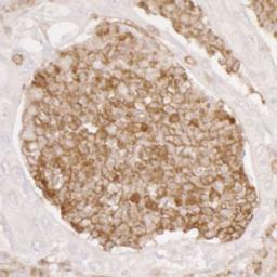 Detection of human ANXA1 by immunohistochemistry.