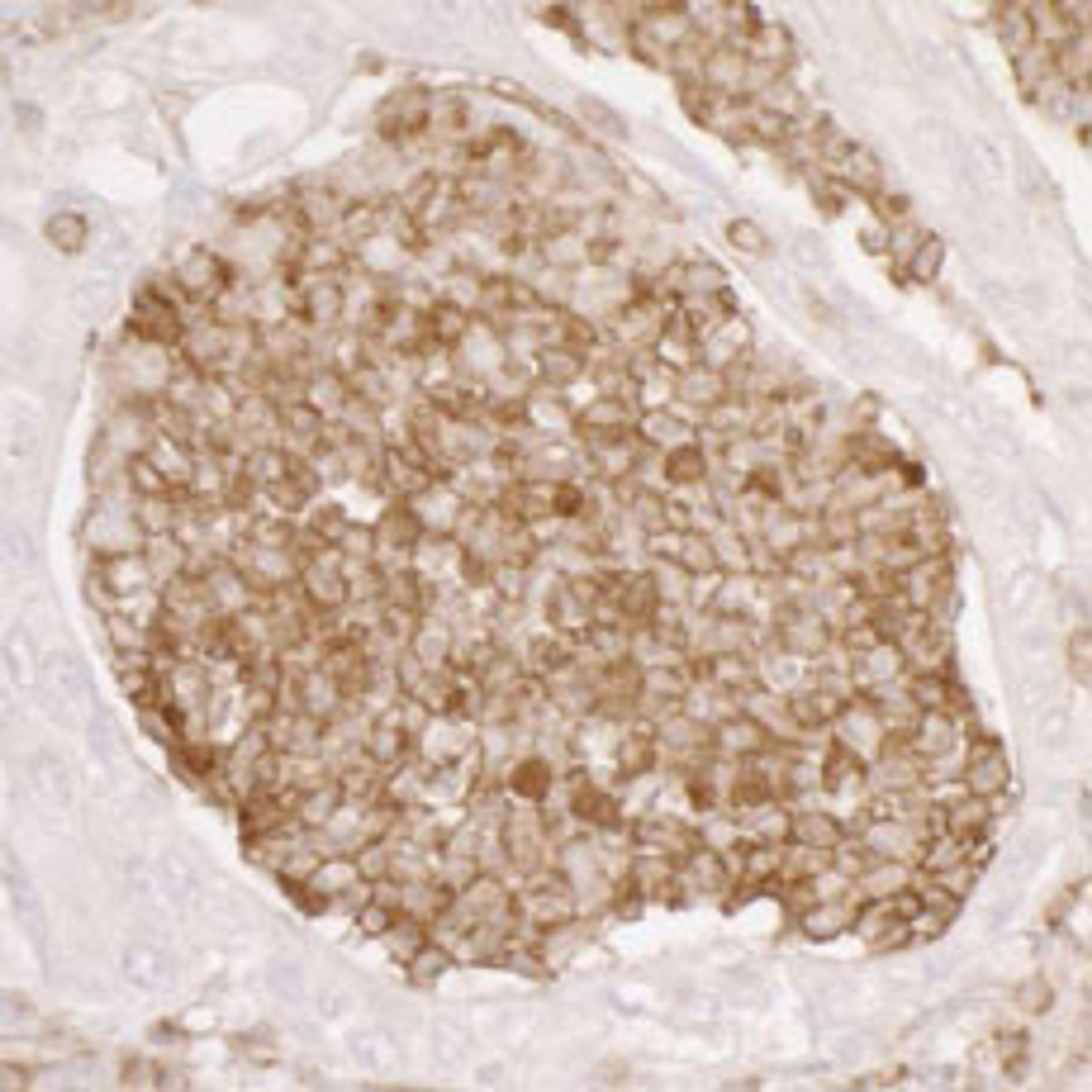 Detection of human ANXA1 by immunohistochemistry.