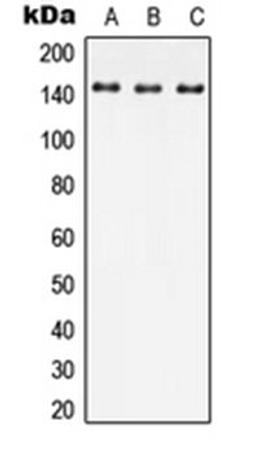 Western blot analysis of HEK293T (Lane 1), Raw264.7 (Lane 2), SP2/0 (Lane 3) whole cell lysates using SPAG9 antibody