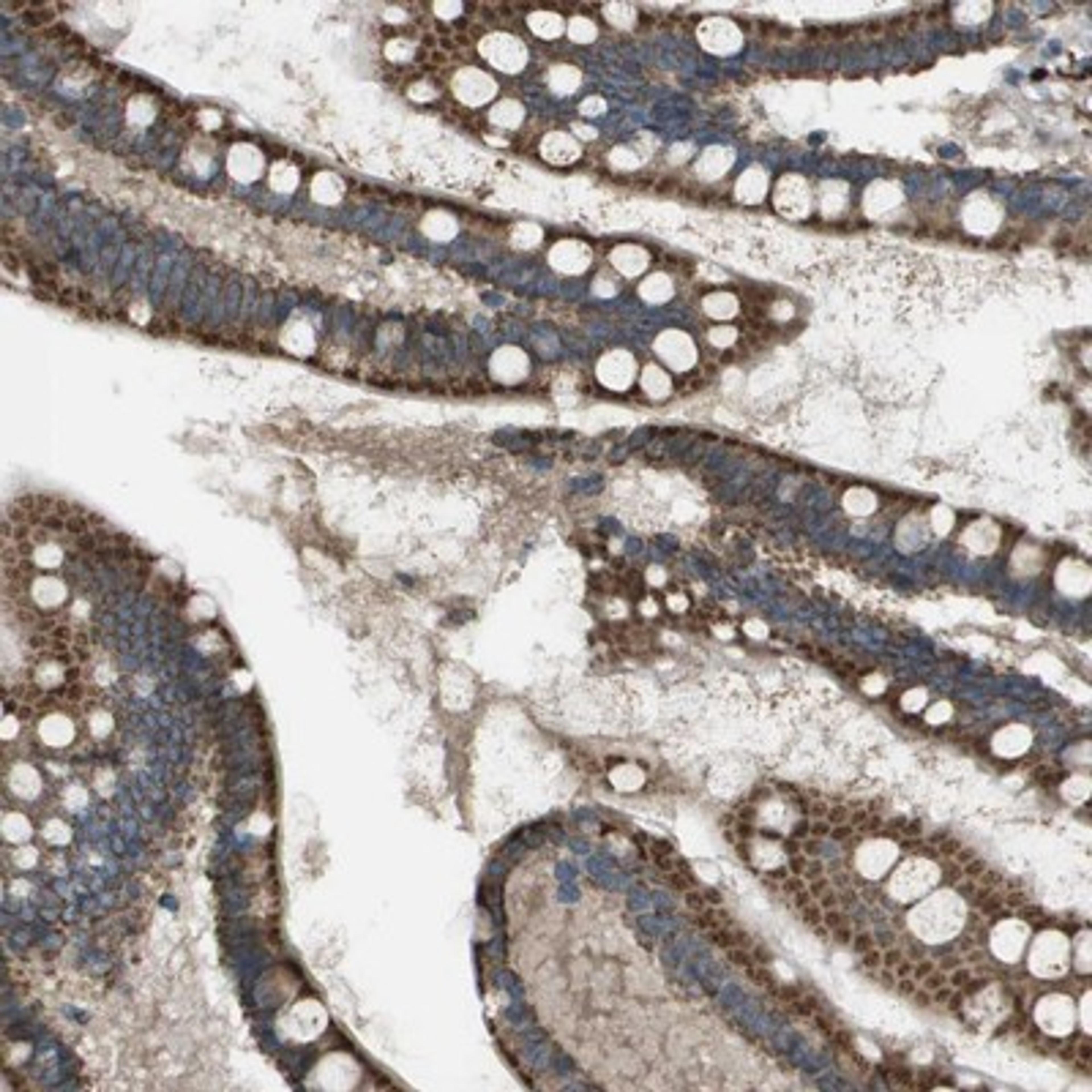 Immunohistochemistry-Paraffin: NRK Antibody [NBP1-84121] - Staining of human small intestine shows strong granular cytoplasmic positivity in glandular cells.