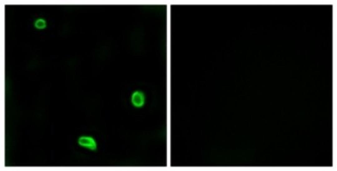 Immunocytochemistry/Immunofluorescence: Proteinase-activated receptor 4 / PAR4 Antibody [NBP1-71365] - Analysis of LOVO cells, using Proteinase-activated receptor 4 / PAR4 Antibody. The picture on the right is treated with the synthesized peptide.