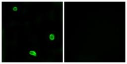 Immunocytochemistry/Immunofluorescence: Proteinase-activated receptor 4 / PAR4 Antibody [NBP1-71365] - Analysis of LOVO cells, using Proteinase-activated receptor 4 / PAR4 Antibody. The picture on the right is treated with the synthesized peptide.