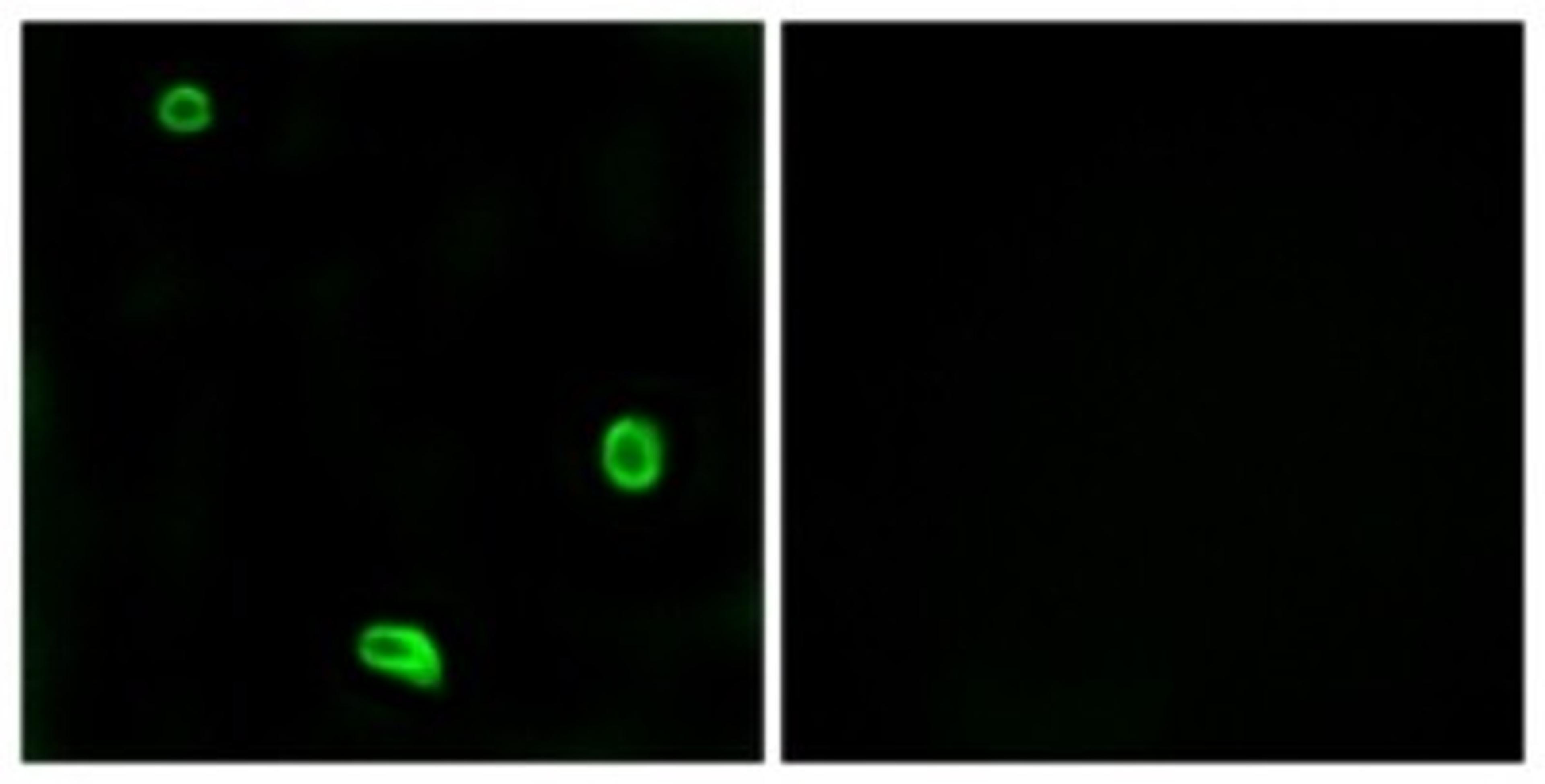 Immunocytochemistry/Immunofluorescence: Proteinase-activated receptor 4 / PAR4 Antibody [NBP1-71365] - Analysis of LOVO cells, using Proteinase-activated receptor 4 / PAR4 Antibody. The picture on the right is treated with the synthesized peptide.