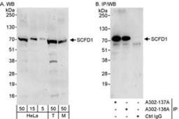 Detection of human and mouse SCFD1 by western blot (h&m) and immunoprecipitation (h).