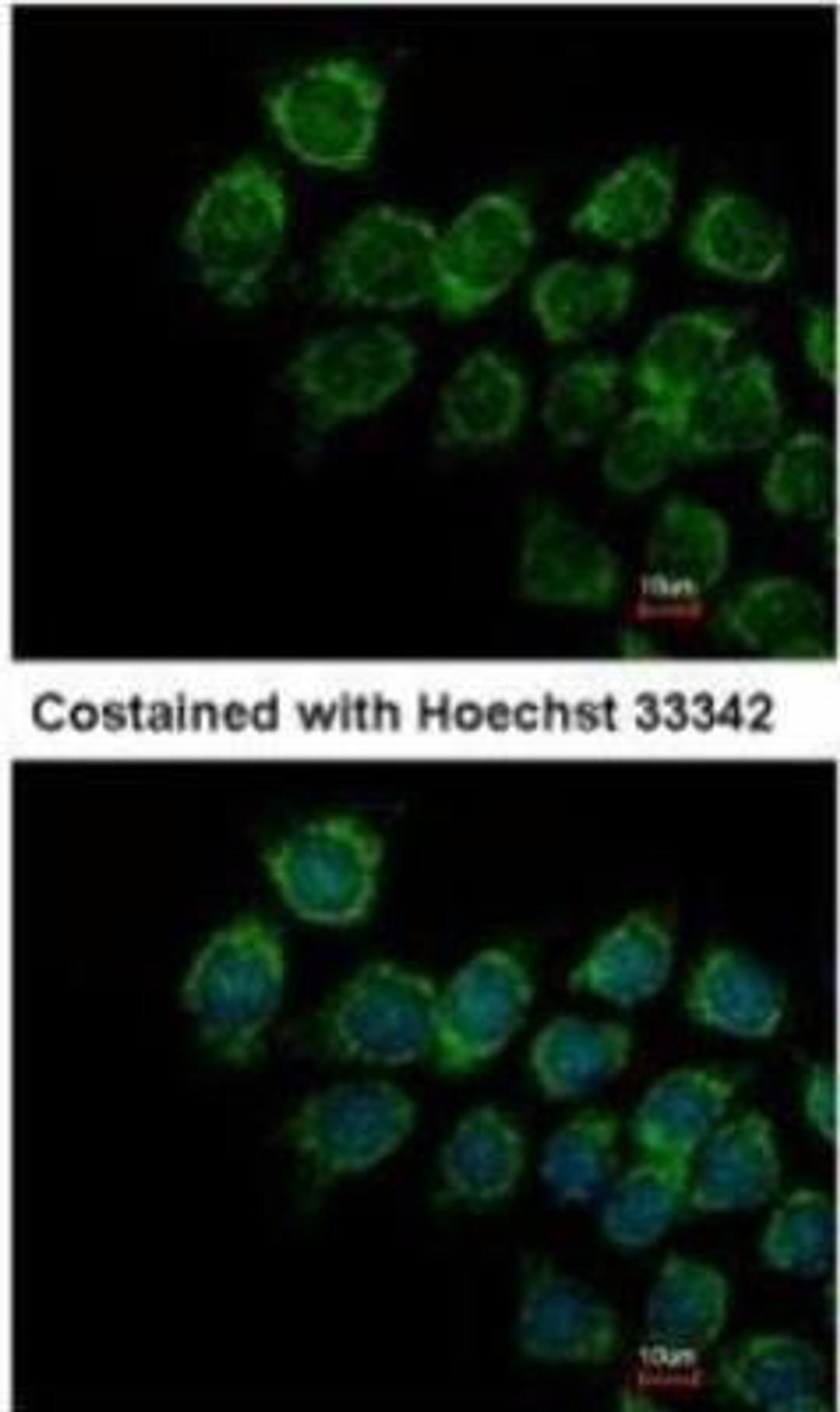 Immunocytochemistry/Immunofluorescence: IFN-alpha/beta R2 Antibody [NBP1-31665] - Analysis of methanol-fixed Hep3B.