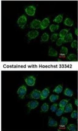 Immunocytochemistry/Immunofluorescence: IFN-alpha/beta R2 Antibody [NBP1-31665] - Analysis of methanol-fixed Hep3B.