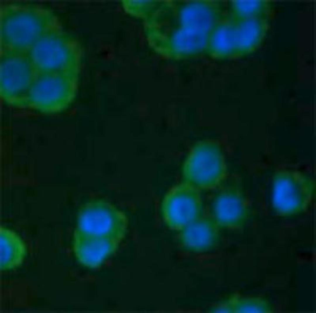 Immunocytochemistry/Immunofluorescence: TIMP-4 Antibody (SB30c) [NBP1-28619] - 5 ug/mL Mouse Anti-Human TIMP-4- was stained on cold methanol fixed human pancraetic carcinoma cells with DAPI and Goat Anti-Mouse Ig, human adsorbed-FITC