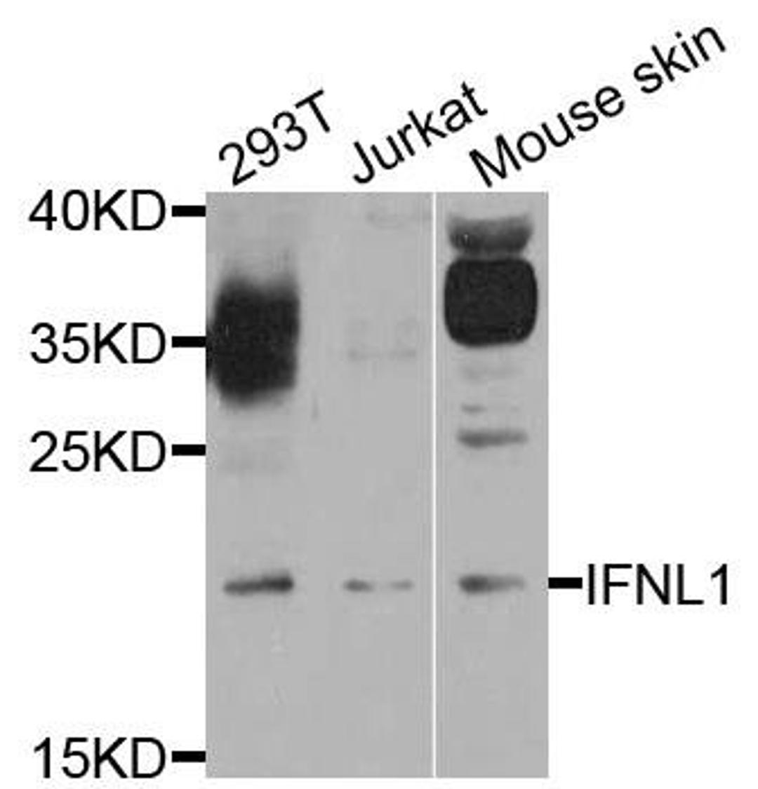 Western blot analysis of extract of various cells using IFNL1 antibody