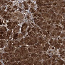 Immunohistochemistry-Paraffin: CCDC39 Antibody [NBP1-90560] - Staining of human pancreas shows strong cytoplasmic positivity in exocrine glandular cells.