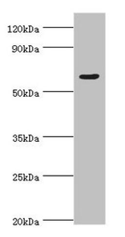 Western blot. All lanes: TATA box-binding protein-associated factor RNA polymerase I subunit B antibody at 4ug/ml + Hela whole cell lysate. Secondary. Goat polyclonal to rabbit IgG at 1/10000 dilution. Predicted band size: 69, 61, 40 kDa. Observed band size: 69 kDa. 