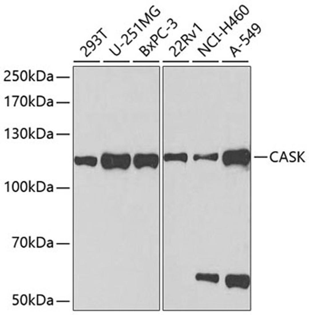 Western blot - CASK antibody (A2501)